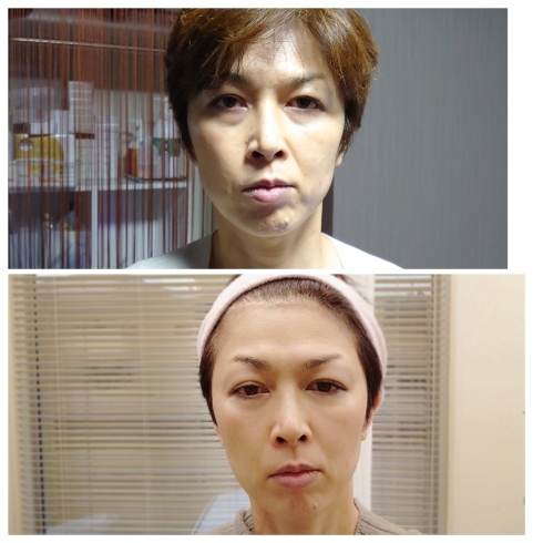 小顔コルギにハイフ プラズマ最強小顔コース O グラ モーレのニュース まいぷれ 松江 小顔コルギにハイフ プラズマ最強小顔コース O グラ モーレのニュース まいぷれ 松江