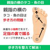「タコ・魚の目の原因は歩き方⁉︎ 【 外反母趾や巻き爪、足の悩み専門整体/千葉県船橋市西船徒歩2分】」