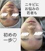 いろんなお悩み、解決に向けてスタートしましょ♡「【マツヤニ】初回体験ってなにするの？全工程を詳しく解説！ 」