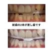 色合わせ「メディカルホワイトニング」