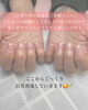 「セルフもいいけどプロに任せる【福井/ネイル/自爪育成】」