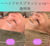 3回目の変化「『肌が綺麗に蘇って感動してます』」