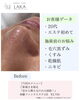 「頑固な毛穴黒ずみ・イチゴ鼻にさようなら＊首から整えるつるんと魅せ肌ケア」