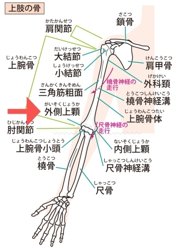 外側上顆「テニス肘とゴルフ肘と外側上顆炎」