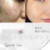 左右同じモデルの写真を使用。※結果には個人差があります。「韓国肌管理専門店PULUNTO（プルント）」
