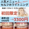 ホワイトニング 初回