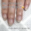 「誰にもバレずに自爪育成【福井市ネイルサロン/自爪育成/自爪風仕上げ】」