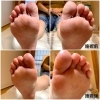 足裏の施術例。「足の専門サロン FIRST STEP」