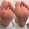 ネイルケア＋足裏角質ケア