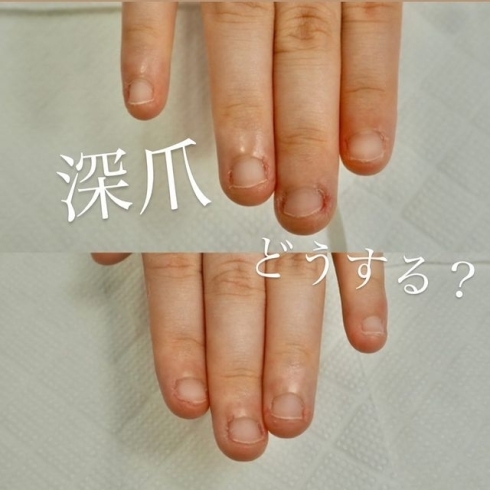 自爪育成 深爪 男爪でもネイルを楽しむ手元に 美爪を追求 ケア重視 福井のネイルサロン Nail Salon Alohaloma アロハロマ のニュース まいぷれ 福井 自爪育成 深爪 男爪でもネイルを楽しむ手元に 美爪を追求 ケア重視 福井のネイルサロン Nail Salon Alohaloma アロハロマ のニュース まいぷれ 福井