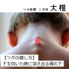 【大椎】風邪-ゾクっときたときに使うツボ-「【茅場町駅徒歩1分の鍼灸院】大椎/風邪-ゾクっときたら使うツボ-」
