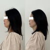 「小顔メニューとセットで美白肌も手に入る！【 福井フェイシャルエステ/福井美白/福井復元フェイシャル/福井美肌/目の下のクマ取り/福井小顔/たるみ改善 】」