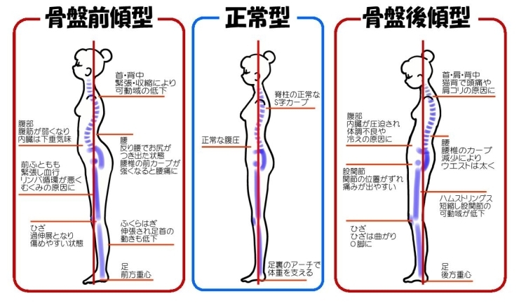 正しい姿勢とそうでは無い姿勢「「鍛える前に整える」動的ストレッチ」