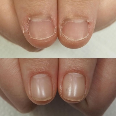 自爪育成 自爪風ネイル オフィスネイルも 美爪を追求 ケア重視 福井のネイルサロン Nail Salon Alohaloma アロハロマ のニュース まいぷれ 福井 自爪育成 自爪風ネイル オフィスネイルも 美爪を追求 ケア重視 福井のネイルサロン Nail Salon Alohaloma アロハロマ のニュース まいぷれ 福井