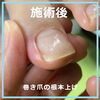 根本から立ち上げて美しい爪に　No.102-4「根本から立ち上げて美しい爪に　No.102」