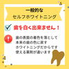 白くは出来ない「セルフホワイトニング」