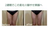 before　after「無理なダイエットはもう終わり！健康的に痩せる♪」