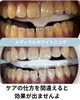 「歯の黄ばみが気になる方へ。白さの変化を実感するメディカルホワイトニング」
