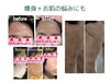 痩身＋お肌の悩みも◎「ルルオンはトータルビューティー」