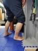 怪我した右はほぼ可動域がありません。「足首の怪我、リハビリが上手くいかない原因は皮膚の硬さかも?」