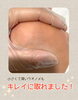 足裏がチクチク⚡️チクチク⚡️「足裏にトゲが刺さったかも⁈」