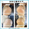 「かかと集中ケア」No.98-2「バキバキのかかと割れをプルプルに「かかと集中ケア」No.98」
