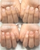 短指症 マムシ指 でも自爪育成 福井市 ネイルサロン コンプレックス Nail Melia Medical Healthcare のニュース まいぷれ 福井