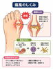 痛風を予防するためには、水分補給をしっかりとし、程度な運動と食事で肥満にならないことです！「よく聞く「痛風」のことを皆さんはどの位ご存じですか？今日は「痛風」に関するお話をさせて頂きます。」