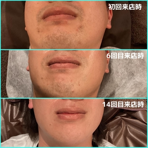 1年ほどご来店頂いてるお客様「before/after✅」