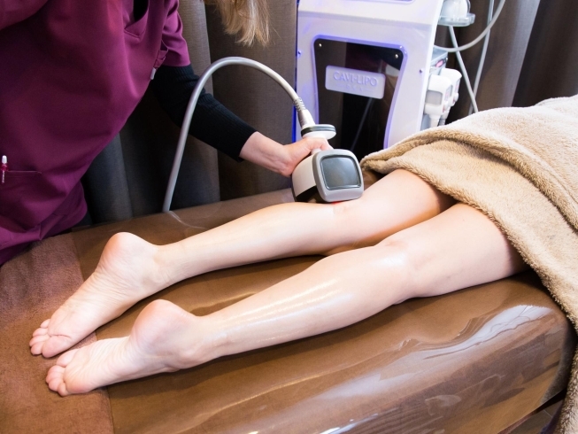 脂肪溶解ダイエット キャビテーション施術「X’mas限定【ダイエット祭り】超お得この機会をお見逃しなく!」