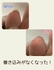 本人からは見えない巻き爪「【巻き爪ケア】まさか巻き爪だったとは…」