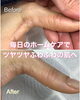 「手荒れ改善【福井市/ネイル/乾燥】」