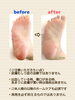 ひそかに気になってる方、いらっしゃいませんか？「【皮膚むしり症】気になっている方へ【フットケア】」