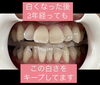 メディカルホワイトニング「メディカルホワイトニング」