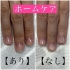 自爪育成 ホームケアについて 福井市 ネイルサロン メディカルネイルプランナー Nail Salon Alohaloma アロハロマ のニュース まいぷれ 福井