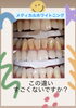 メディカルホワイトニング「第一印象は“歯”で決まる！？当店で笑顔と印象アップのお手伝い」