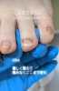 痛みを抑えた自慢の巻き爪ケア「4趾（薬指）の巻き爪補正ビフォーアフターをご紹介」