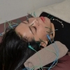 美容鍼（全身鍼灸治療・顔周辺マッサージ含む）+通電4箇所