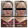 「✴︎エステbefore・after✴︎」