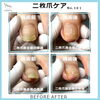 二枚爪！除去後はコーティングし割れ欠けを防止2「二枚爪！除去後はコーティングし割れ欠けを防止　No.101」
