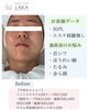 「首元が変わればお肌も変わる＊首から整えるソニックエステ」