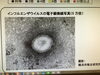 「【センター北のうんち薬局 漢方ハタ薬局】〜 横浜のインフルエンザ情報 〜  下痢・便秘・腰痛・膝痛・神経痛・自律神経・睡眠・後鼻漏 漢方相談」