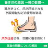 「巻き爪の原因！足の専門家が解説！【 外反母趾や巻き爪、足の悩み専門整体/千葉県船橋市西船徒歩2分】」