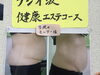 「暑さでマスクを取った途端に…！？　佐賀のなかしま鍼灸整骨院！」