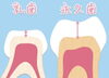 「子供の歯は麦茶でも歯が溶ける！？ #福岡#大野城歯科#むし歯#歯を大切に」