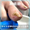 No.104ー３「長年痛みをこらえて切っていたお爪　No.104」