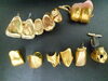 こちらもわかりやすい金歯ですね♪「買取専門 金のクマ 沼津店　金歯だけじゃく入れ歯にも金が使われている物があります」