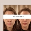きたじ愛が教える 幸せを呼ぶ 小顔・整顔術（表情も効果も衝撃的
