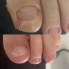 陥入爪