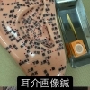 耳介画像鍼治療
